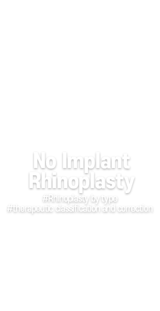 
No Implant Rhinoplasty
#Rhinoplasty by type
#therapeutic classification and correction